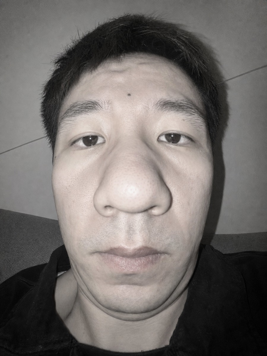 前置灾难现场示例